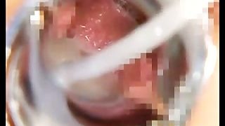 Vagina felching asian nurse
