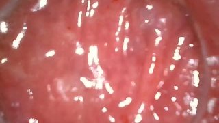 久しぶりにアナル　内視鏡してみたよ